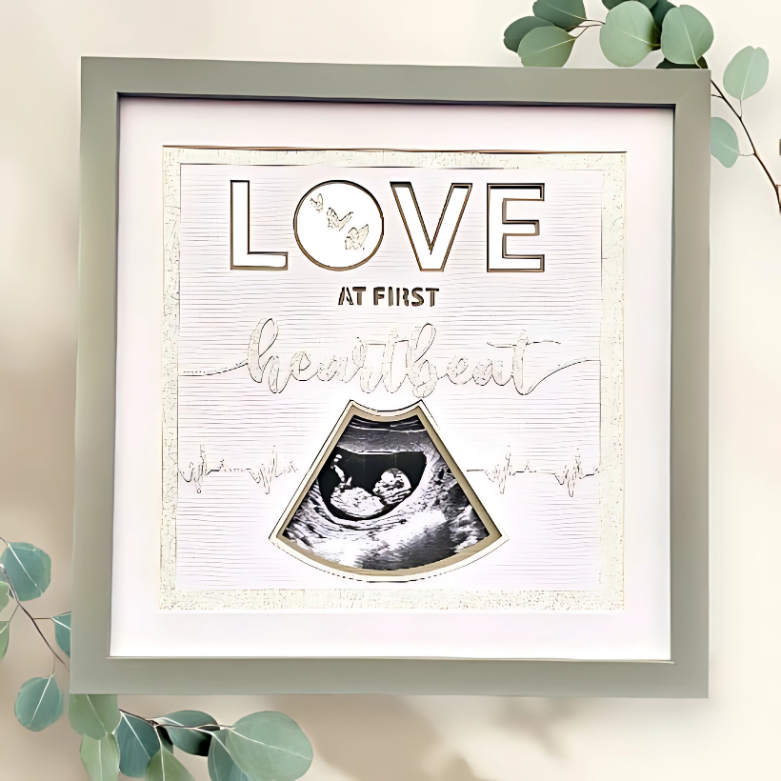 Love at First Heartbeat – Personalised Scan Picture Frame