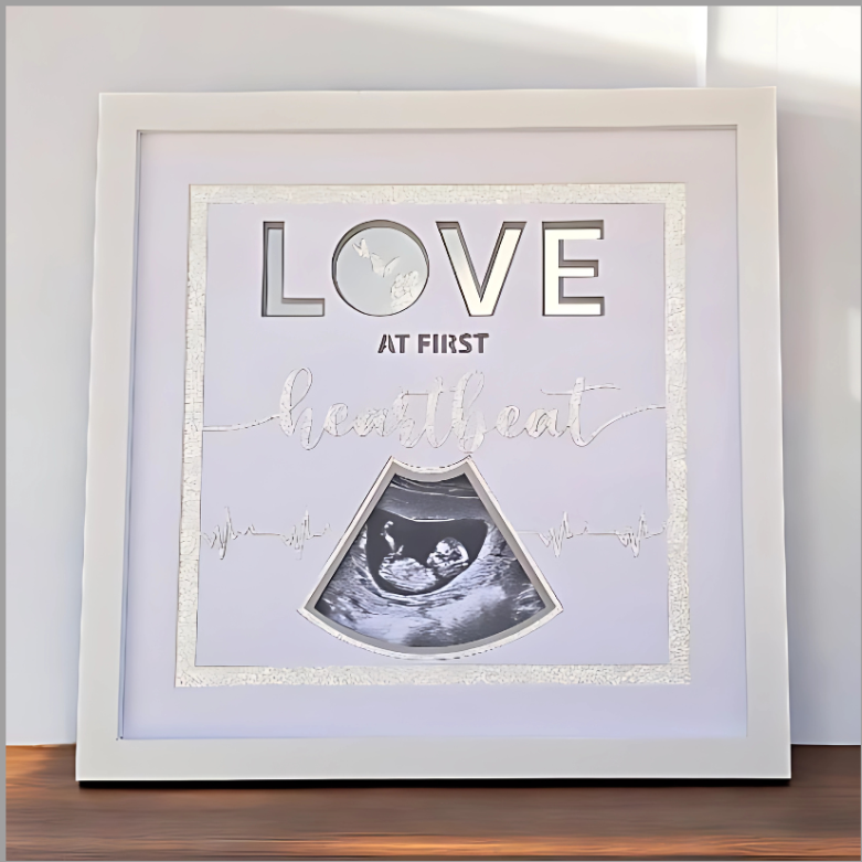 Love at First Heartbeat – Personalised Scan Picture Frame