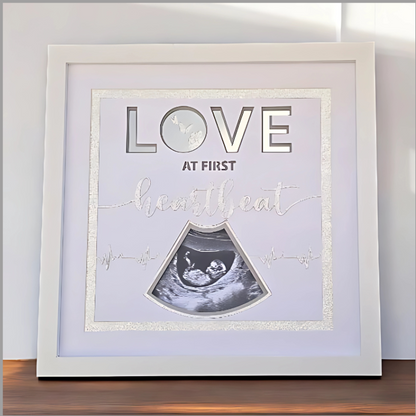 Love at First Heartbeat – Personalised Scan Picture Frame